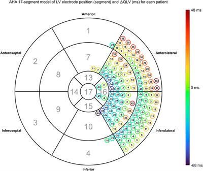 Non-invasive estimation of QLV from the standard 12-lead ECG in patients with left bundle branch block